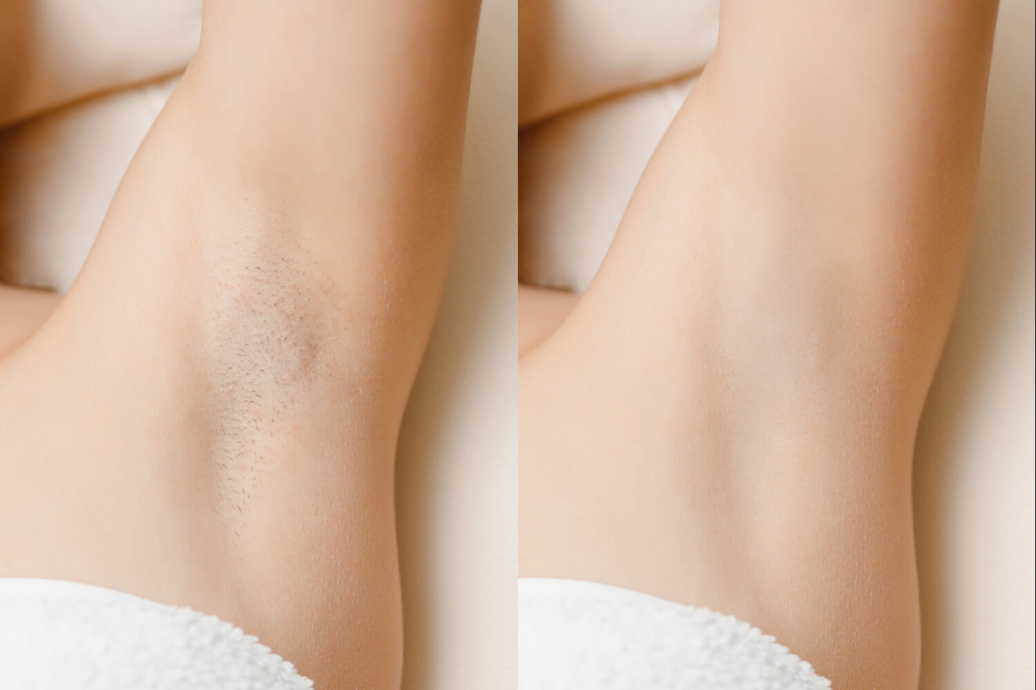 Laser Treatment at Life Holistics North East